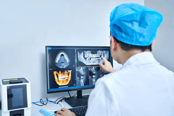Best Emergency Wisdom Teeth Removal in Shallotte, NC